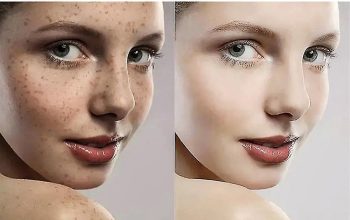 Skin Bleaching And Whitening Products In Fomboni City in Mwali, Comoros Call ☏ +27710732372